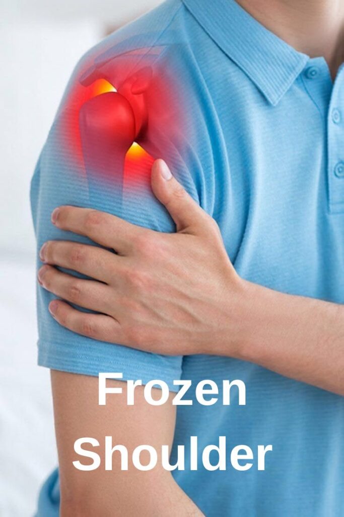 frozen shoulder